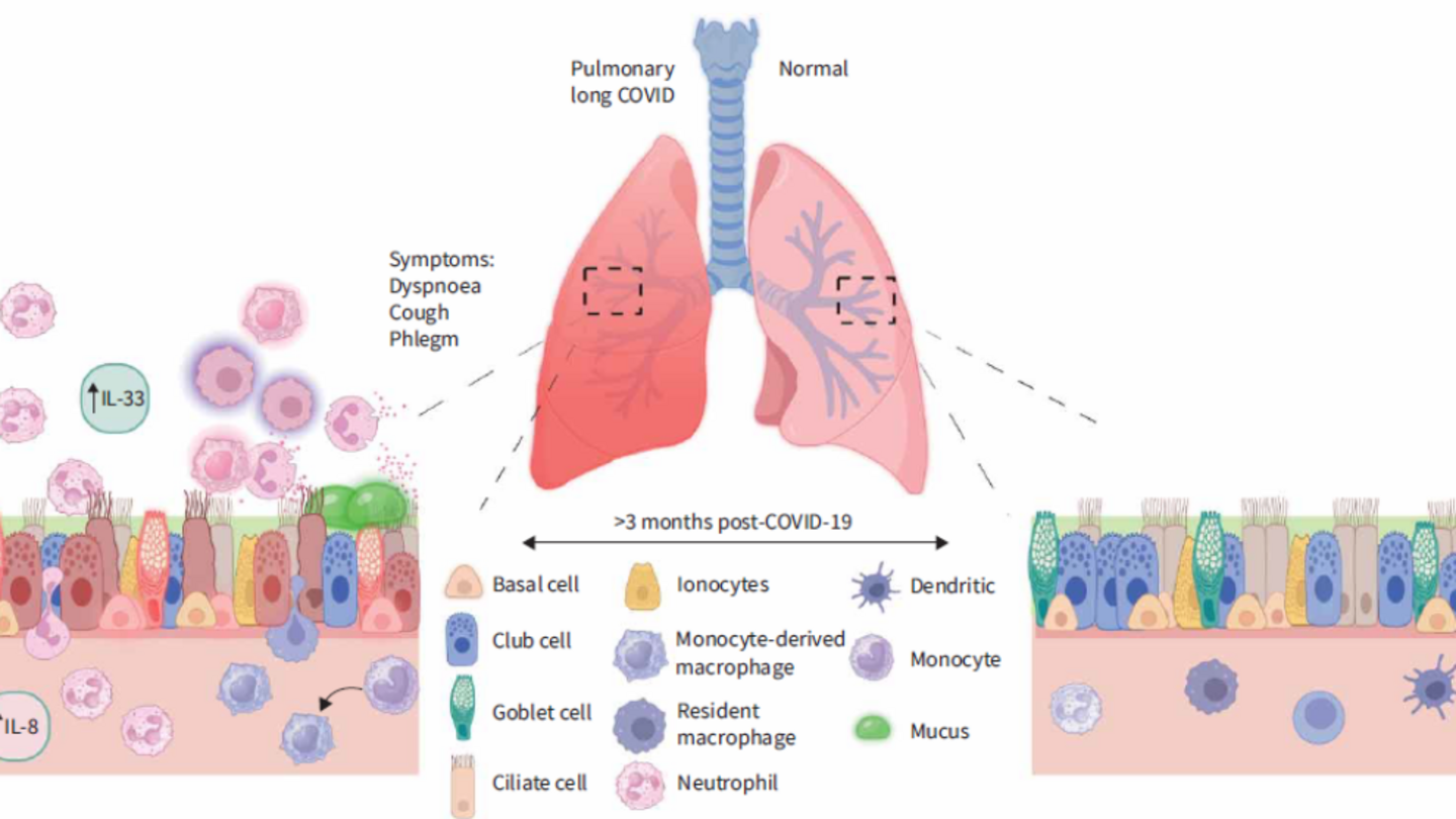 A proposed landscape of the small airways with pulmonary long COVID.
