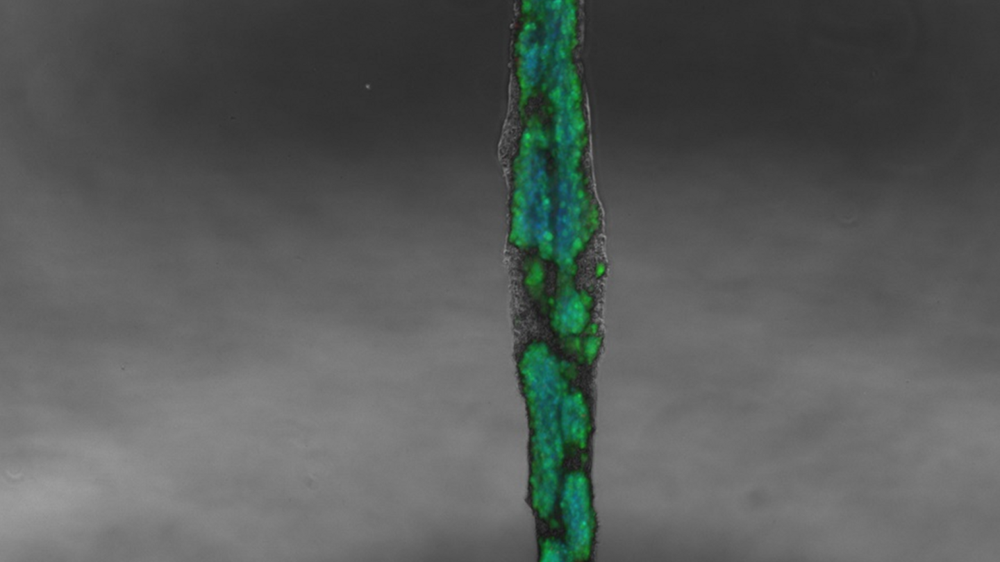 3D-printed human tissue sample