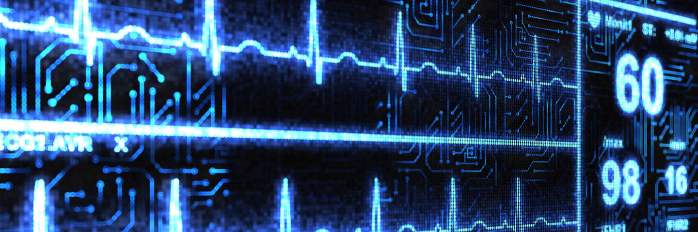 Heart monitor display