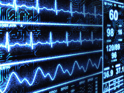 Heart monitor display